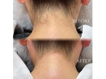 アンドエー(and A.)の雰囲気（【うなじwax】アップヘアがもっと映えるうなじ美人へ♪）