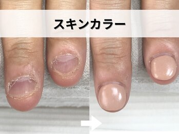 ブルームーンネイルズ(BLOOMOON.nails)/スキンカラー