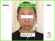 ラ セラフィータ 中目黒/オンダリフト＋EMS