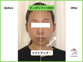 ラ セラフィータ 中目黒/オンダリフト＋EMS