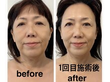 エステティックラフ 黒田店(Laugh)の雰囲気（効果に自信あり筋膜リリース1回の施術でこの結果！）