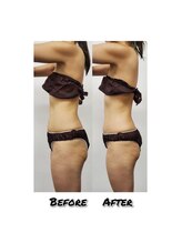 エミット(emit.)/くびれる整体　ビフォーアフター