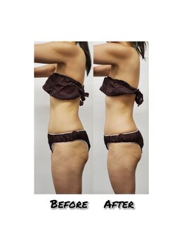 エミット(emit.)/くびれる整体　ビフォーアフター