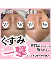 ホワイトワックス 名古屋金山店(WHITE WAX)/くすみ一撃