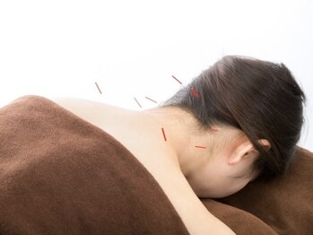 セキ鍼灸院の写真/辛い首肩こりに悩む方…、鍼施術がオススメ!!カウンセリングで凝りの原因を把握し、ツボに集中アプローチ★