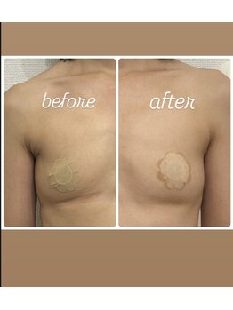 エルミナ.(elmina.)/痩せ型でもバストだけ大きく