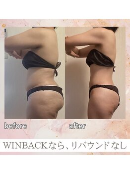 エソール(essor)の写真/４0代でも大幅減量を目指す！最新痩身機器で一気にダイエットしたい方◎最強痩身WINBACK×神業ハンド