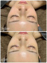 ラグ(LUXU)/美白と透明感アップ◎