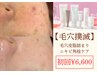 〈毛穴洗浄＋潤い補給＋小顔＆首肩コリマッサージ〉毛穴撲滅フェイシャル