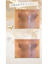 ルミナ(Lumina)/before⇒after