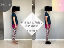 ウェルサス(WELLSUS)/巻き肩が改善♪肩こり頭痛も卒業