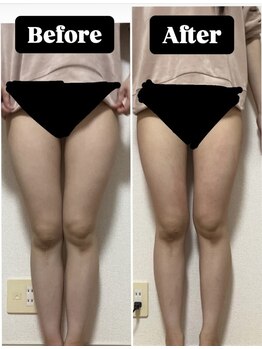 ヴォアール 東静岡店(VOIR)/スリミングクリーム2週間の結果