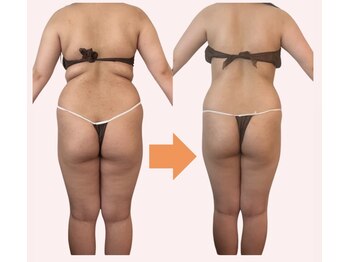 マシェリ(Ma che'rie)/後ろ姿も美しい