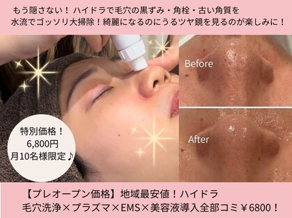 頭のオアシすぱ【毛穴×小顔×ヘッドスパ】の写真