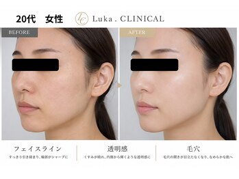 ルカクリニカル(Luka.CLINICAL)の写真/美容看護師監修◎徹底カウンセリング×効果重視の施術で理想のお肌へ★