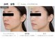 ルカクリニカル(Luka.CLINICAL)の写真/美容看護師監修◎徹底カウンセリング×効果重視の施術で理想のお肌へ★