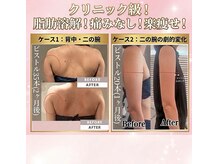 ルアナ(Luana)の雰囲気（脂肪を撃退！小顔♪二の腕にも♪ダウンタイムなし！）