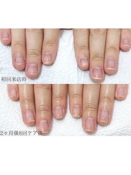 ゴッダスネイル(GODDESS NAIL)/自爪育成/地爪育成/爪育