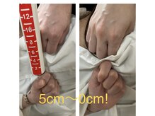 くまがい整体院 若松店/猫背矯正