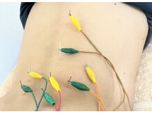 小嶋鍼灸治療院/全身調整鍼灸マッサージ