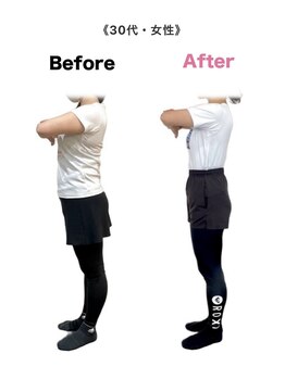 アンカーフィット(ANCHORFIT)/◆施術例◆反り腰の改善