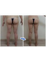 ビューティースパ/むくみやすい足/リンパで解消♪