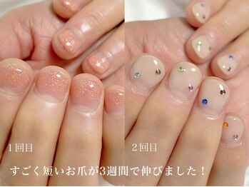 ウィッチ(witch)/60代の方3週間で驚きの変化です