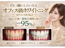 ホワイトニングプラス(Whitening+)