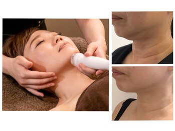 素肌美人/脂肪たるみ撃退！レモンボトル