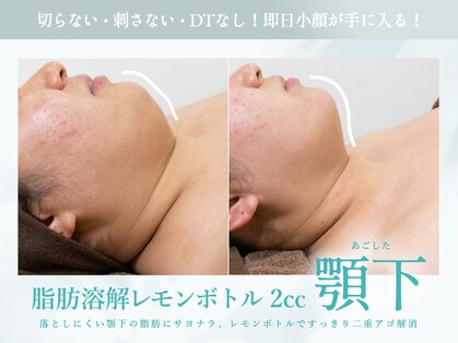 ソウルスキンの写真