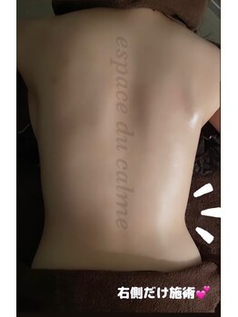 カルマーアンドビー(Calmer & Be.)/【バスト】Before/After