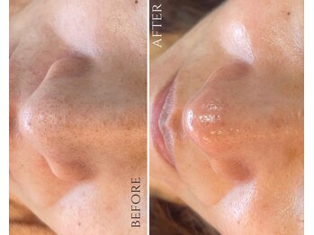 ザ ヴォーグ(the VOGUE)/くすみ、黒ずみ、お任せください