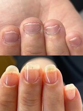 ハッチネイル(HACCI nail)/お客様Beforeafter