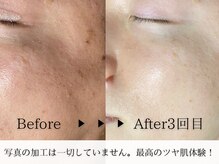 ザ プレザント 大倉山(the pleasant)の雰囲気（韓国アイドルのようなツヤと透明感のある肌質改善が得意です！）