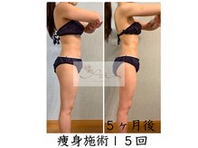 アイ エステサロン(Ai)/【30代】想像越えの痩せ姿☆