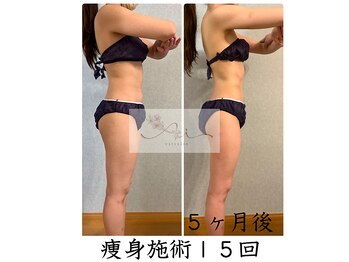 アイ エステサロン(Ai)/【30代】想像越えの痩せ姿☆