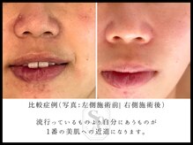 韓国肌管理室 ソア(soa)/【トロイピール】