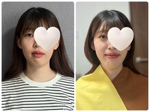 キラリナ/20代☆ペアトータル診断