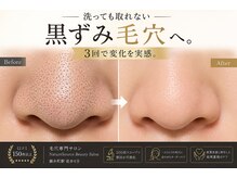 ナチュラ ソース(NatureSouce)