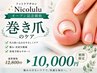 オープン記念価格 【巻き爪補正!繰り返さない!】