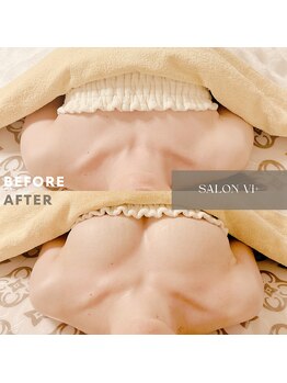サロン ヴィプラス(SALON Vi+)の写真/胸だけじゃない。全身を整えるバストケアで、理想のシルエットづくりを。