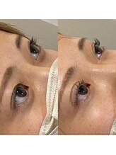 クレールビビ 南国店(CLAIR BiBi)/まつ毛パーマ/ラッシュリフト