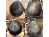 【メンズ人気！頭皮集中ケア】ヒト幹細胞上清液で育毛促進