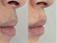 ハリウッドブロウリフト ワクシー 表参道店(HOLLYWOOD BROW LIFT WAXYYY.)/ フェイスワックス