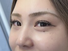 オメメ(Omeme)/◇施術image◇