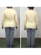 フェルナ(FERNA)/Before/After