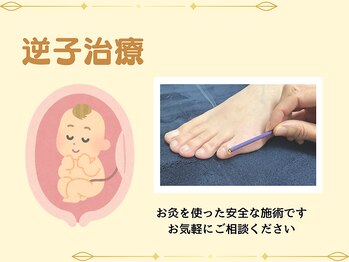 すぎやま整骨院 鍼灸院 宮原院/【逆子施術】