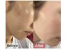 【大人気の毛穴洗浄】毛穴レス★たまご肌♪￥25000→￥18000