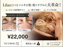 リラ 都城店(Lilas)