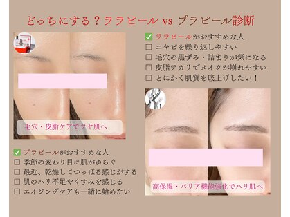 ドルチェナッツ ネオ 府内店(dolce nuts NEO)の写真